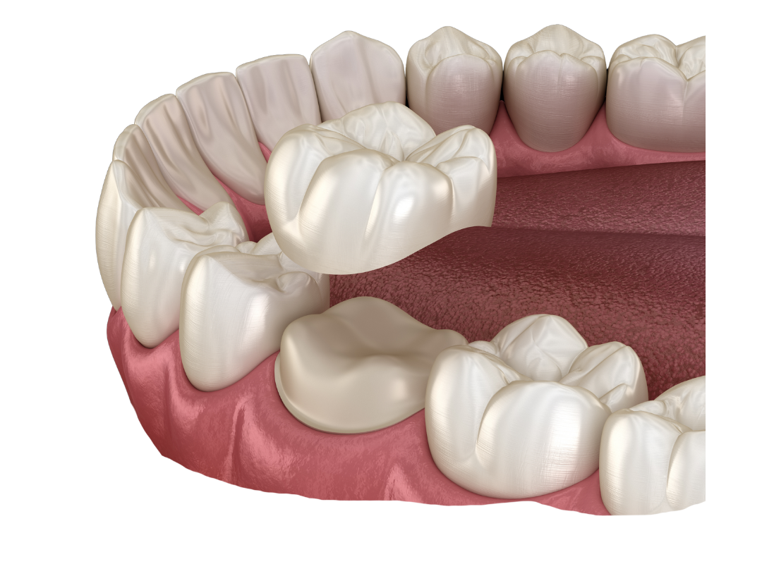 Dr. David Zelby | Prosthodontist Marietta, GA | Cosmetic Dentist